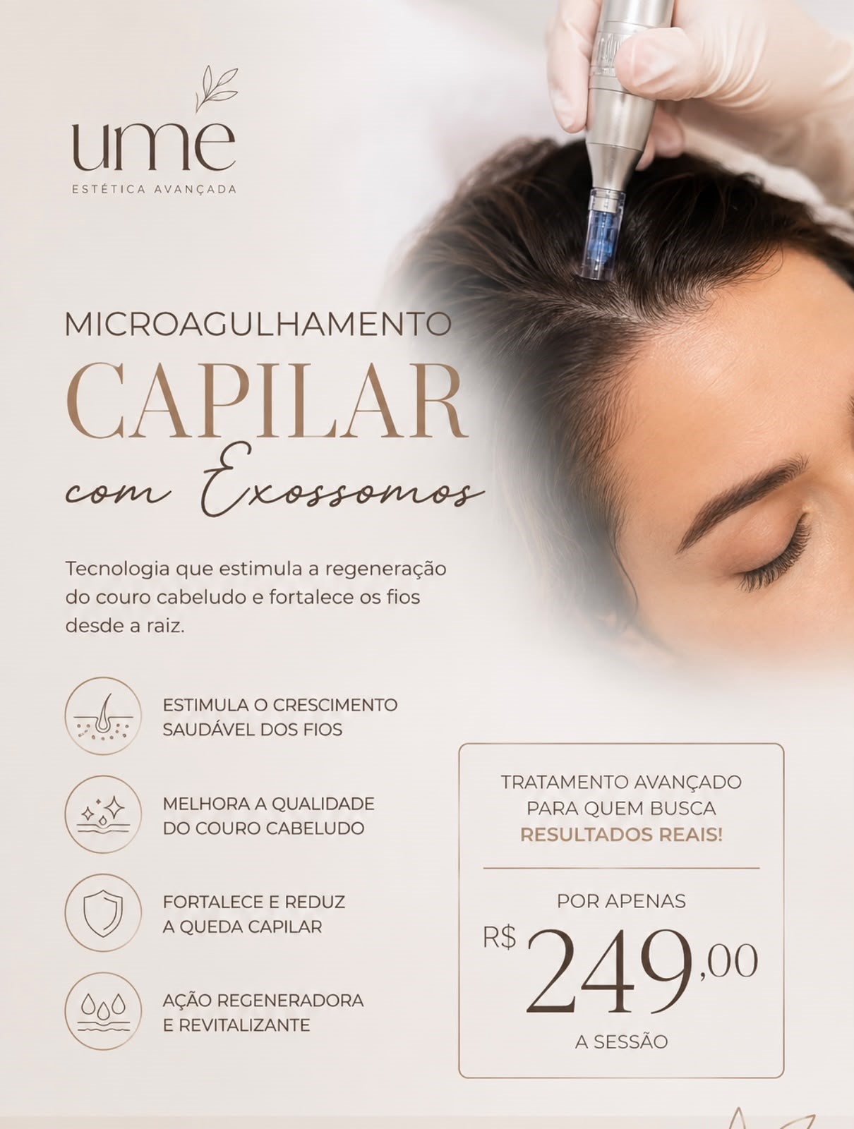 Imagem da promoção de Microagulhamento com Exossomos